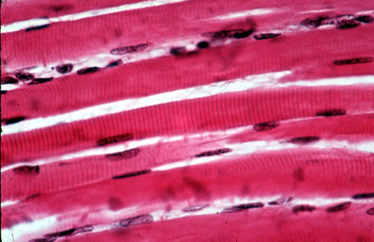 In ordine di grandezza: Muscolo 1- Miofibra: cellula muscolare 2- Miofibrille: fasci di miofilamenti 3- Miofilamenti: actina e miosina Fascio di fibre