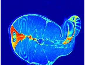 METODI DI VALUTAZIONE QUALITATIVA MRI Comparazione immagini trote