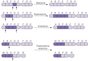 MUTAZIONI CROMOSOMICHE Riarrangiamenti BILANCIATI o SBILANCIATI: il dosaggio genico complessivo rimane inalterato anche con modificazione nella struttura oppure la mutazione è accompagnata da perdita