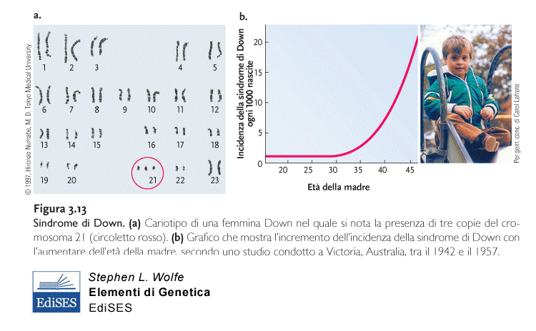 Sindrome di Down (Trisomia 21) La più frequente causa costituzionale di ritardo mentale 1/400 concepiti 1/700 nati vivi Errori di non disgiunzione (95%), soprattutto in meiosi I a livello materno