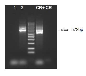 Peste americana Viene utilizzata una Nested Touchdown PCR per l'amplificazione di un frammento di 572 bp appartenente al gene codificante per la subunità piccola del 16s rdna del Paenibacillus