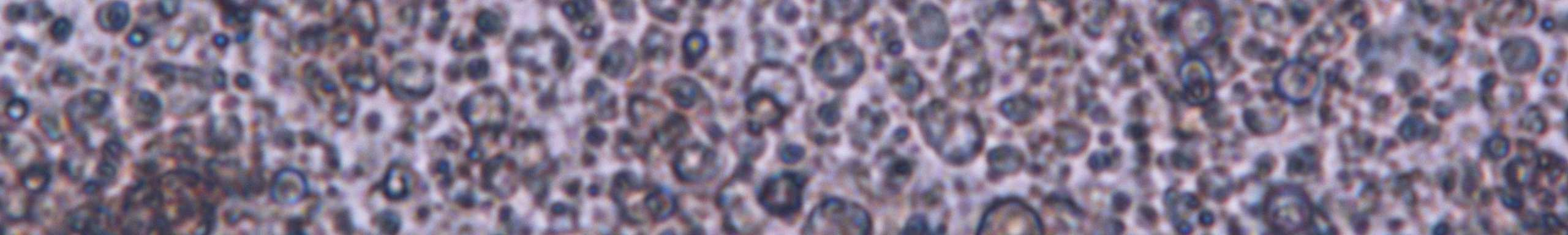 Ottenimento e mantenimento in vitro di una linea cellulare di Apis mellifera (al momento non ancora disponibile) per la diagnostica delle principali