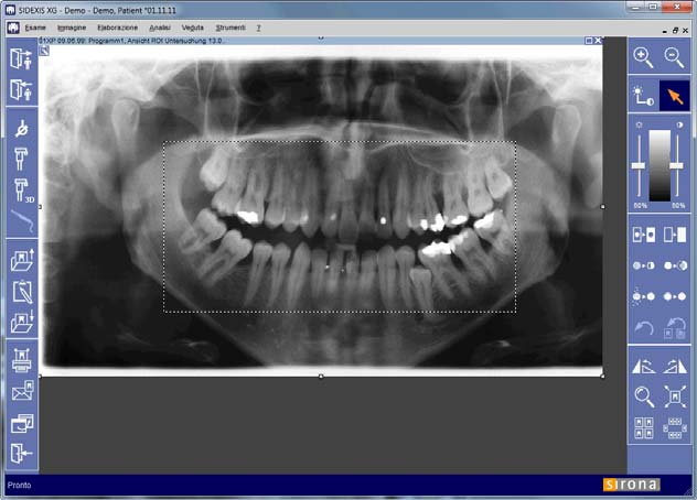 4 Stampa tramite SIDEXIS Sirona Dental Systems GmbH 4.1 Stampa dell'immagine Richiamo della funzione Visualizzazione della funzione 4.1.2 Stampa dell'area di interesse (ROI) Presupposto Deve essere impostata un'area di interesse (ROI).