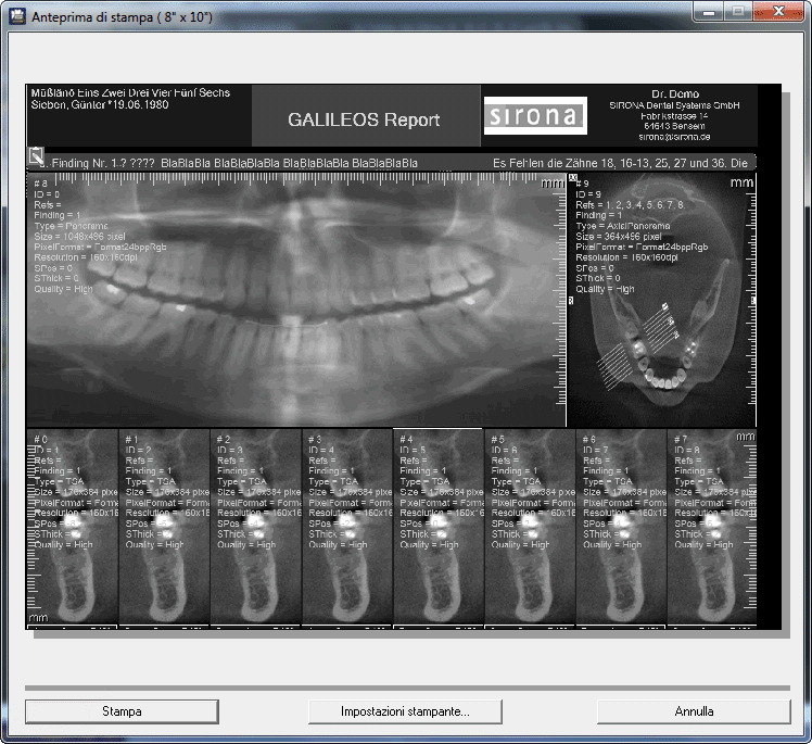 4 Stampa tramite SIDEXIS Sirona Dental Systems GmbH 4.2 Stampa dell'esame 5. Selezionare le dimensioni pellicola desiderate e confermare con "OK". 6.