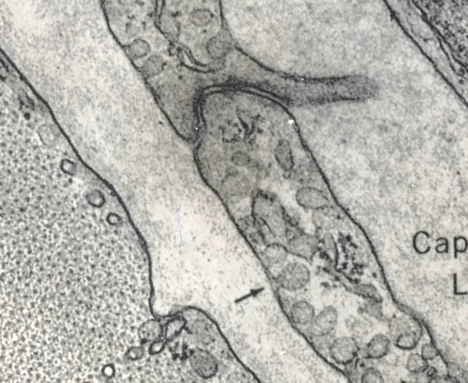 Sistemi di giunzione Citoplasma di una fibra muscolare: microfilamenti spessi e sottili Spazio intercellulare