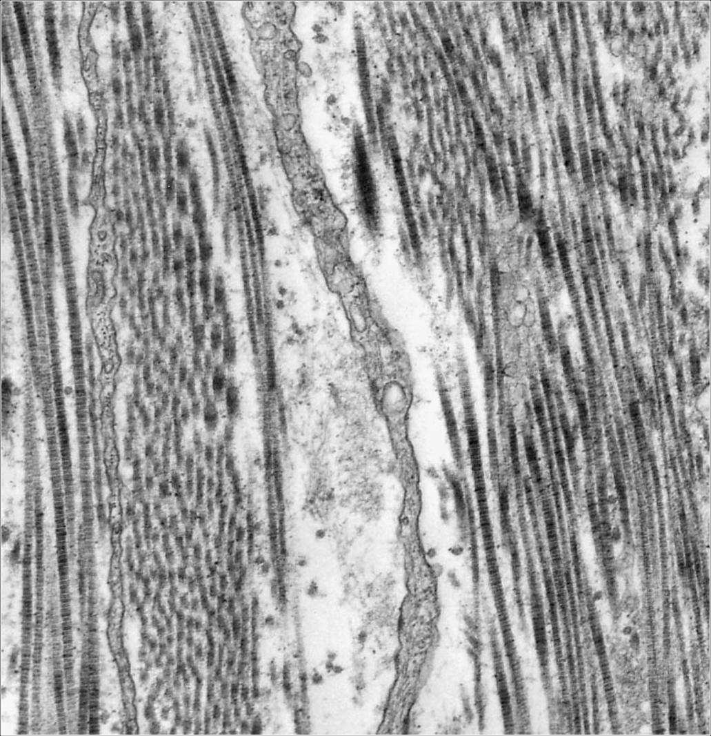 Prolungamento di un fibroblasto Sostanza fondamentale Fibrille