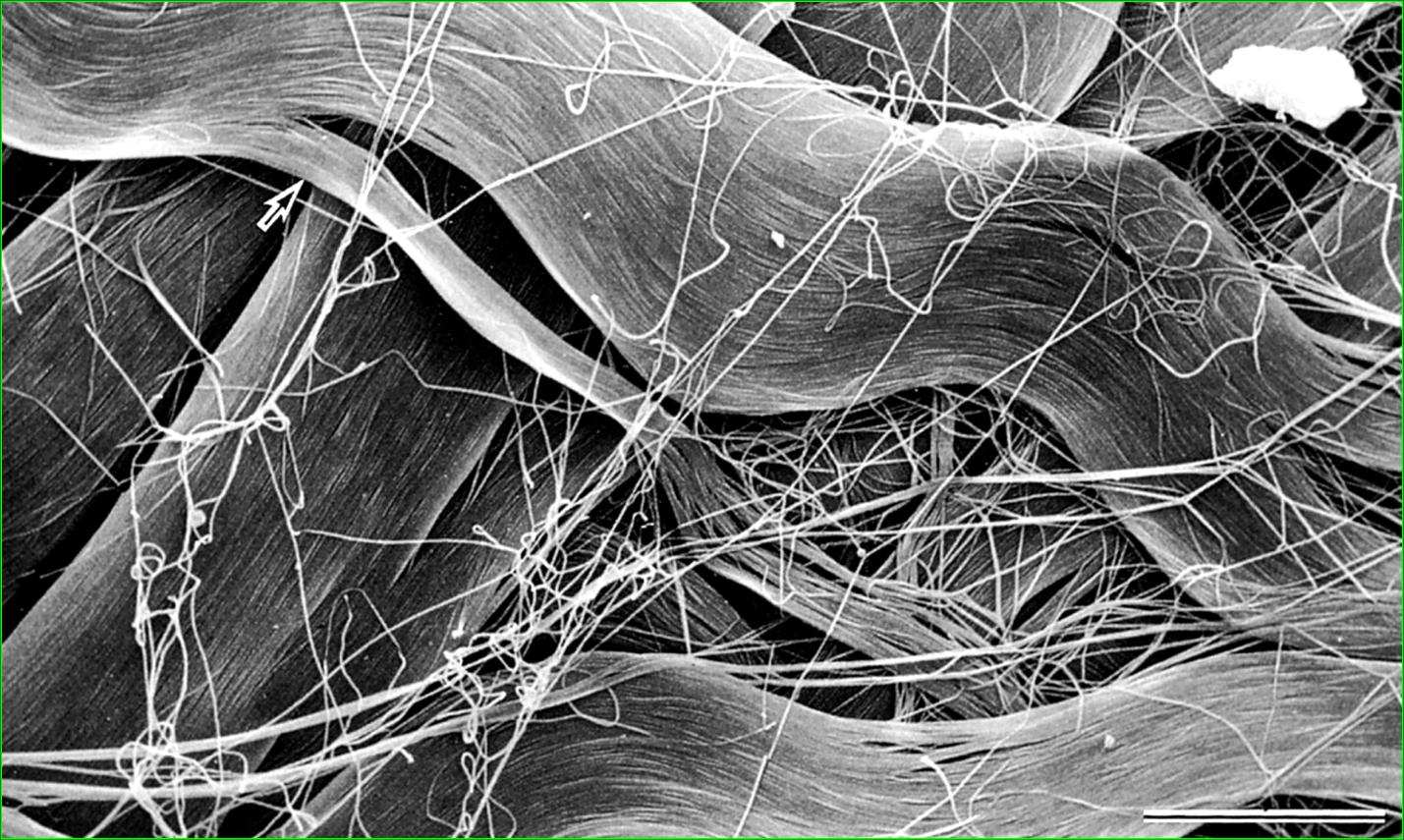 A B Fibre collagene (A) e fibre reticolari (B) al SEM.