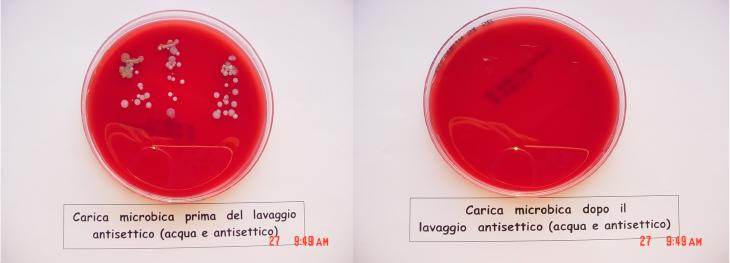 Il lavaggio delle mani Si riconoscono tre livelli di lavaggio delle mani, secondo le procedure che si va ad eseguire: LAVAGGIO SOCIALE: con acqua corrente e sapone;