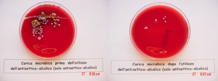 La frizione con prodotti idro-alcolici soluzione ottimale per migliorare l aderenza alle procedure di decontaminazione delle mani Lavaggio con acqua e