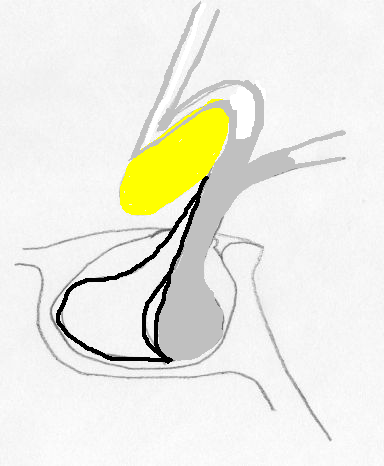 Anatomia sagittale C a. Pars tuberalis b. Pars distalis c. Pars intermedia d.