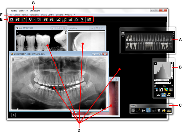 Panoramica della finestra di imaging La finestra di imaging consente di accedere a tutte le funzioni di imaging.