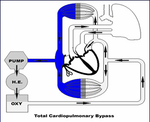 Circolazione extracorporea DEFINIZIONE Metodica utilizzata per sostituire, in maniera totale o parziale, la funzione del cuore e dei polmoni durante