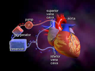 Circolazione extracorporea DEFINIZIONE Il sangue venoso dalle vene cave e/o dall atrio destro viene