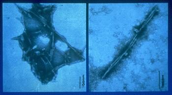MICROSCOPIA ELETTRONICA Scrapie associated fibrils (SAF) Fibrille scrapie Microfotografia computerizzata La proteina prionica PATOLOGICA tende a depositarsi sotto forma di fibrille