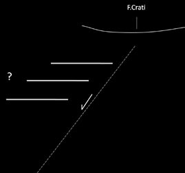 di alcune centinaia di metri verso ovest la successione pleistocenica (figura 6.14). Figura 6.13: Panoramica dell area di studio, nella quale la freccia indica la faglia Donnici-S.