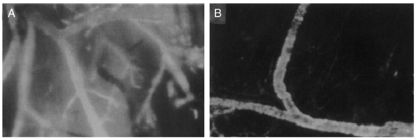 TARGETING PASSIVO Estravasione di PEG-Liposomi (dim 126 nm) dai vasi tumorali Nessuna estravasione di PEG-Liposomi (dim 126 nm) dai tessuti normali Il targeting passivo consiste nel