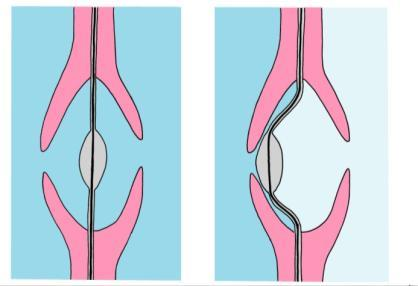 2. Tessuto conduttore nelle Gimnosperme Presenza di fibrotracheidi per il trasporto di acqua e sali minerali Sottili vasi di conduzione che svolgono contemporaneamente la funzione di conduzione e