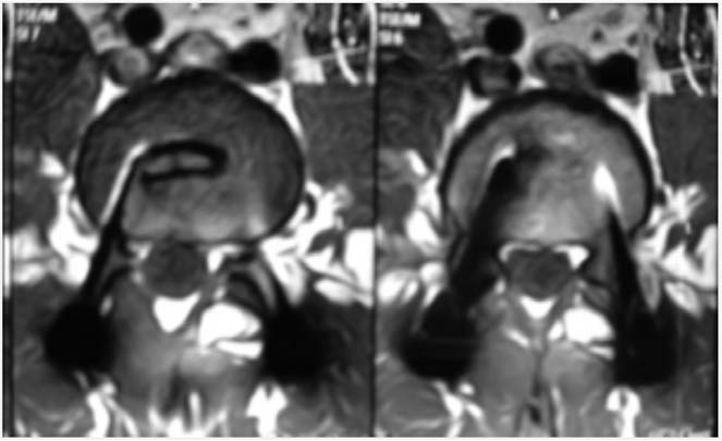 Fig. 10 - Controlli tc ed rm post operatori.