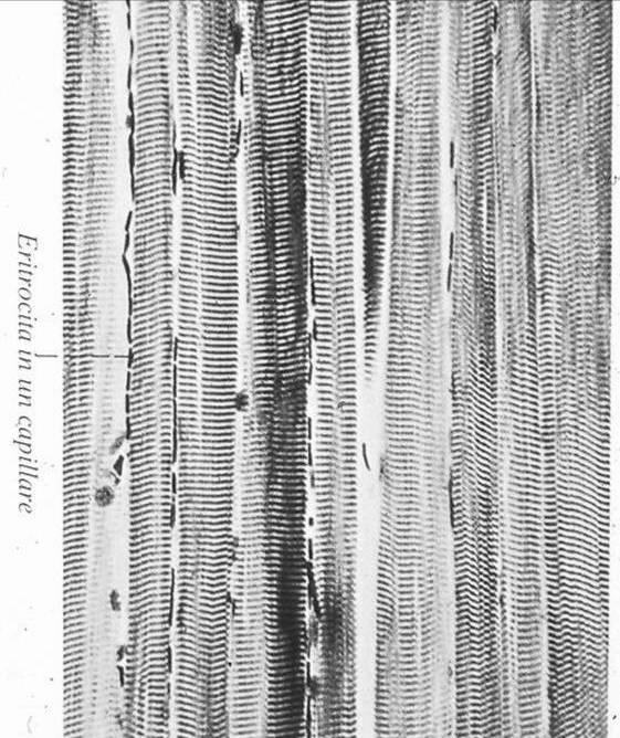 Il t. muscolare striato