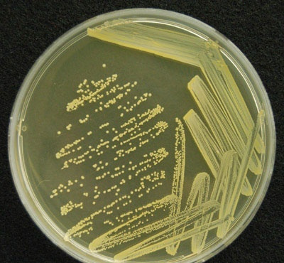 1. Introduzione: selezione dei ceppi batterici Come si selezionano batteri per uso alimentare?