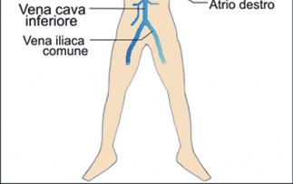 Sistema delle vene cave La vena cava superiore deriva dall'unione delle due vene brachiocefaliche, Deriva dalla vena cardinale anteriore destra (La vena