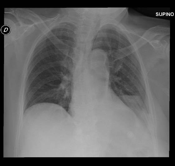 Andamento radiologico 27/11/2015 persiste sostanzialmente