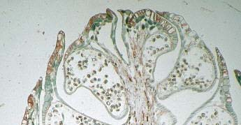 Microsporofilli