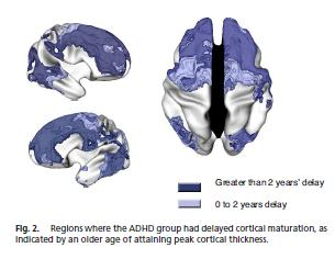 Attenzione ADHD MECCANISMI FISIOPATOLOGICI + - - + ++ Dopamina, Noradrenalina Shaw P et al.