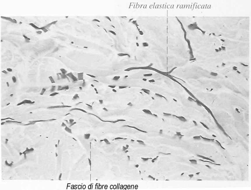 Le fibre elastiche Colorazione