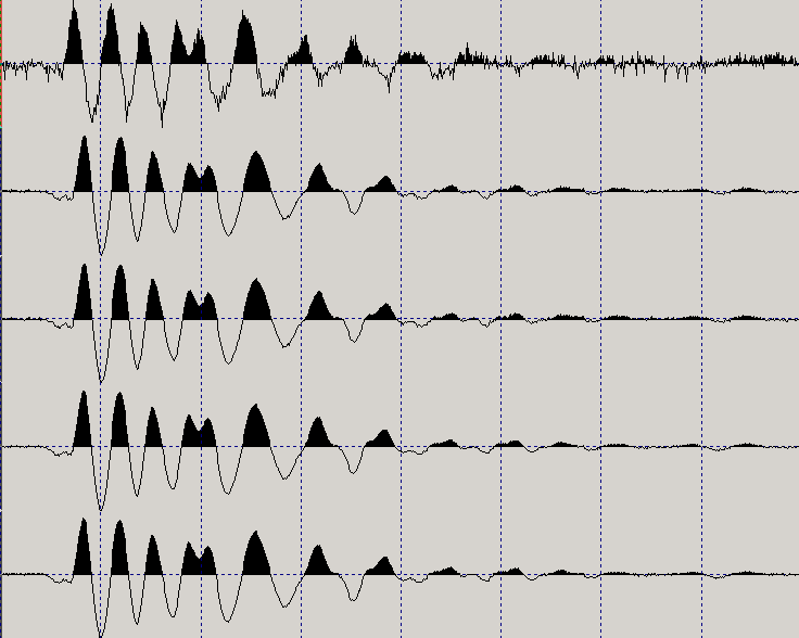 visibili 2 tipi di stacking con 10 e 20 battute (diagrammi in scala) (C) 2010 - SARA electronic