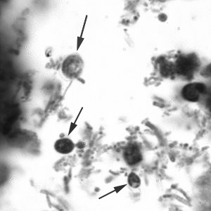 documentata a partire dagli anni 90 Unica specie riconosciuta patogena per l uomo è Cyclospora cayetanensis Pochi focolai