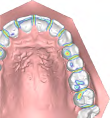 Planmeca Romexis Strumenti 3D per gli ortodontisti ed i laboratori odontotecnici Planmeca Romexis 3D Ortho Studio offre