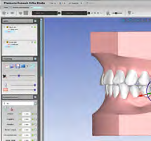della base virtuale, il controllo dell occlusione e le misurazioni versatili dei denti e dell arcata.