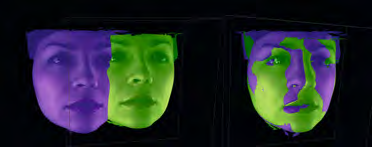 È anche possibile scattare una foto separata in 3D del viso senza esporre il paziente alle radiazioni.