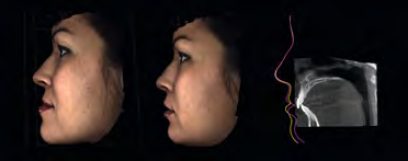Chirurgia facciale più sicura e veloce La foto in 3D visualizza i tessuti molli in relazione con i tessuti ossei e