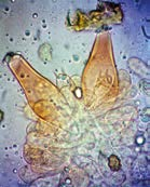 I. cf. piceae: A) Spore 100x B) Cistidi 40x C) Cistidi 100x Cistidi imeniali 60-85 x 23-30 µm ventricosofusiformi o anche sublageniformi, pareti ammonio positive di spessore fino a 4.