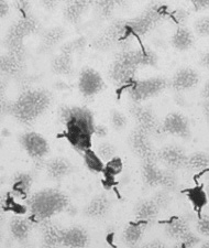 Stimolazione della produzione di anticorpi circolanti cross-reagenti verso batteri