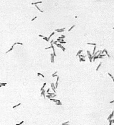 Virulenza Nell ambito di una singola specie microbica, ceppi diversi possono presentare un diverso grado di patogenicità attraverso differenti meccanismi: 1.