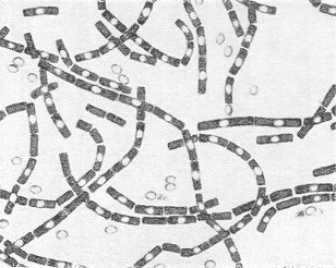 Carica infettante Variabili relative all organismo ospite E una caratteristica che varia da una specie microbica all altra. Bacillus anthracis Staphilococcus aureus Età. Sesso.