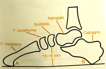 Cenni anatomici Il piede è formato da 26 ossa di diverse dimensioni,poi