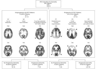 Evaluation of Dementia: Predicting