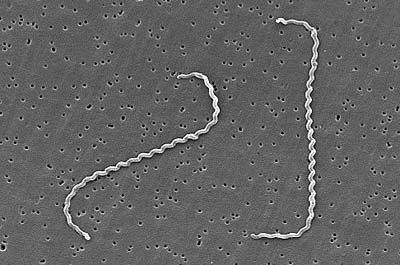 Filamento assiale: flagello interno presente solo nelle spirochete Spirochete: