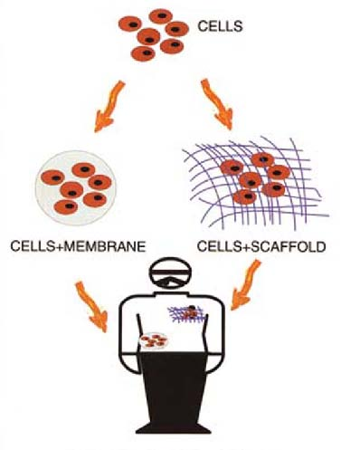 Le sfide dell ingegneria chimica: applicazioni mediche 34 Molto importante è l applicazione di bioreattori nei quali, seminando delle cellule su un substrato costituito da un polimero biocompatibile,