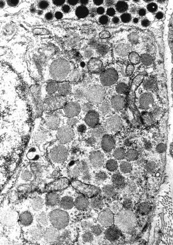 jpg Granuli di somatostatina Metodo all immunoperossidasi Le cellule delta