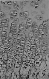 ipertrofiche Zona delle cellule in degenerazione Sostanza fondamentale