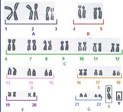 3. IL CARIOTIPO UMANO L insieme completo di tutti i cromosomi metafasici di una cellula è definito cariotipo; il cariotipo è specie-specifico e quello umano normale diploide è costituito da 46