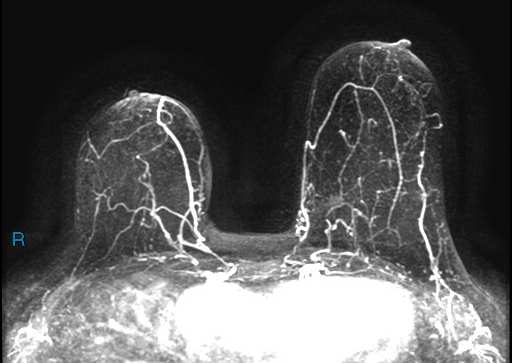 Indicazioni Risonanza Magnetica Pz.