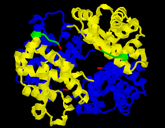 27 HbA1c is the stable adduct of glucose to the N-terminal amino acid, valine of the