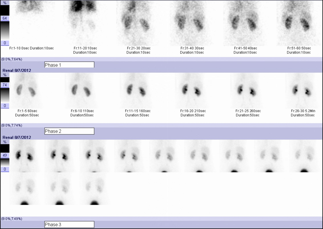 Tecniche di Imaging in Medicina Nucleare