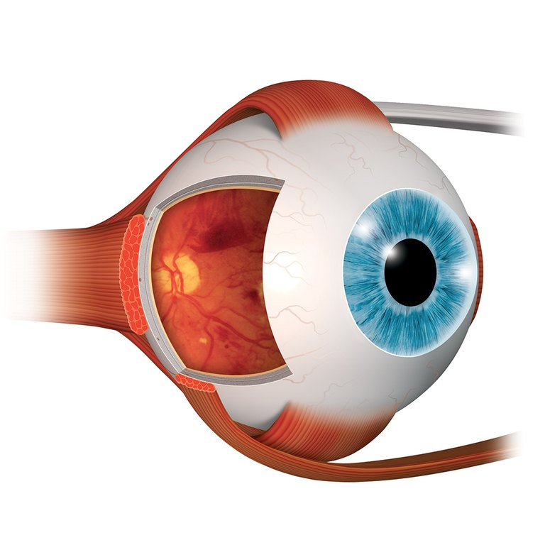 Eye anatomy Eye anatomy 2009 - Struttura anatomica dell'occhio 2009 - Eye